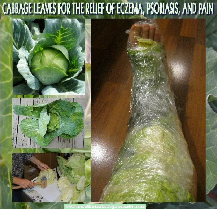HERBAL HEALTH TIP - CABBAGE WRAP FOR WOUNDS, ECZEMA, PSORIASIS AND PAIN