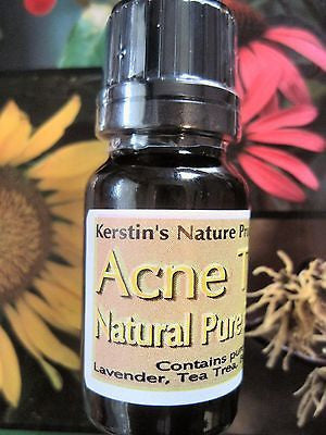 Acne Treatment, Natural Pure Essential Oil Blend ~Multiple Sizes - Kerstin's Nature Products